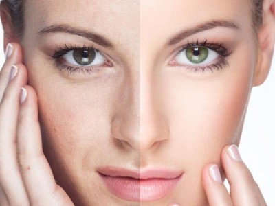 Radiant Skin Best Skin Whitening Dubai 2025