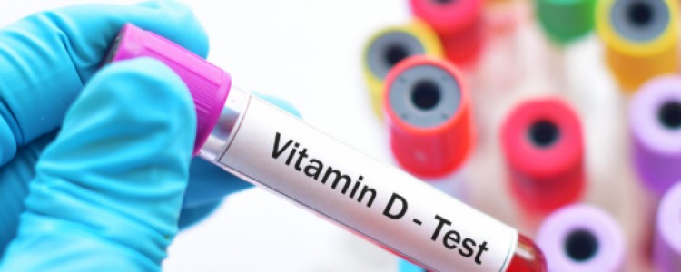 Vitamin D Test Price: Importance, Procedure, and How to Book Online