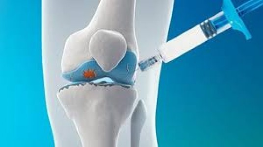 Viscosupplementation Market Size Forecast 2025-2033: Segmentation, Innovation, and Growth Drivers