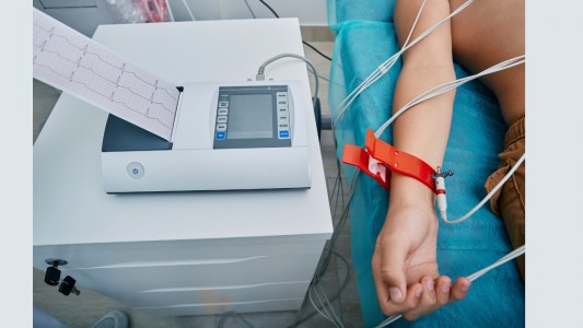 Comprehensive Guide to ECG test Bangalore